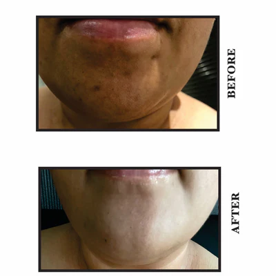 YearnSkin Naicinamide Cleansing Gel